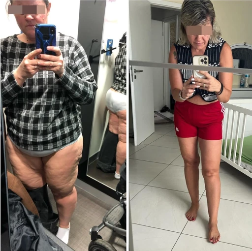 Piernas desinflamadas