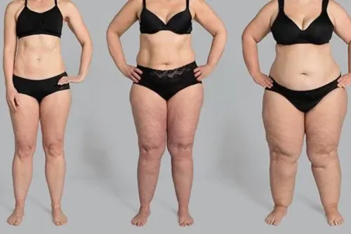 Tres mujeres con diferentes tipos de cuerpo